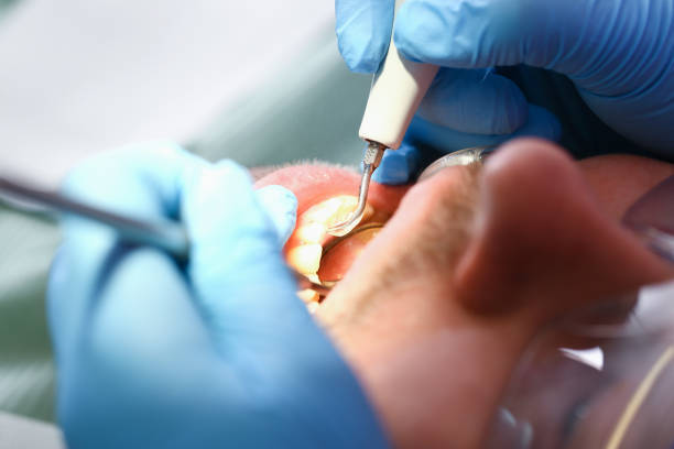 Best Weekend Emergency Dentist in Arlington, VA