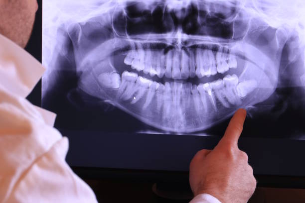 Best Emergency Dentist for Lost Fillings or Crowns in Arlington, VA