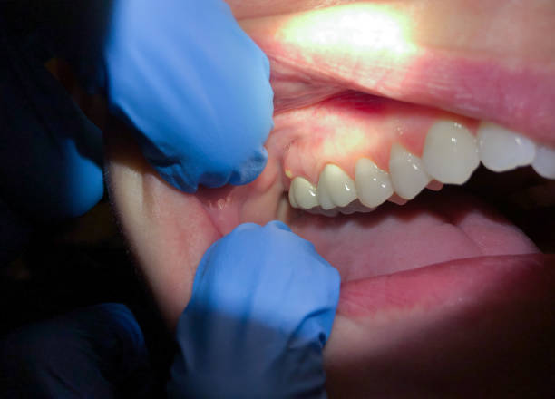Best Emergency Cosmetic Dentistry in Arlington, VA