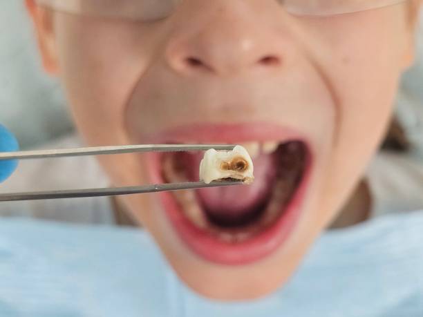 Best Mobile Emergency Dentist in Arlington, VA